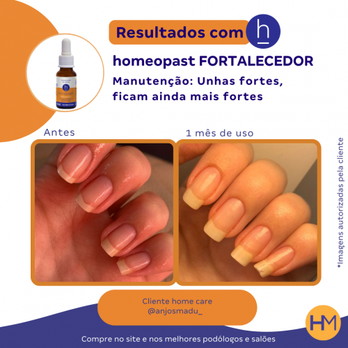 Fortalecedor de Unhas